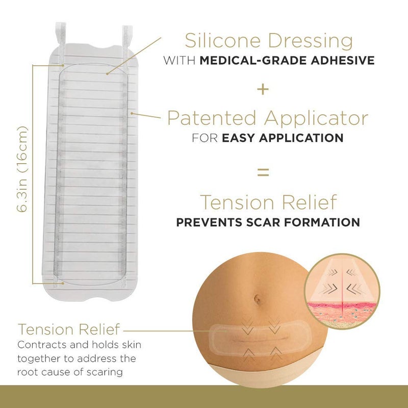 Embrace Active Scar Defense for New Scars, FDA-Cleared Medical-Grade Silicone Scar Sheets for Hypertrophic & Keloid Scar Treatment, 6.3 Inch, Extra-Large, 30-Day Supply - Image 2